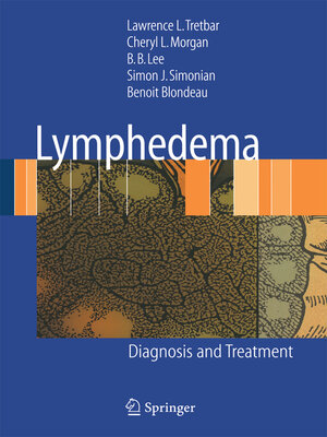 cover image of Lymphedema